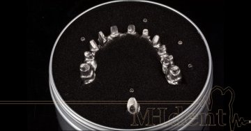 Zhotovení hybridního třmenu s integrovaným individálním abutmentem